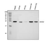 SOD2 (MnSOD) Antibody in Western Blot (WB)