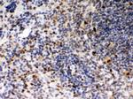 PU.1 Antibody in Immunohistochemistry (Paraffin) (IHC (P))