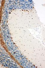 SSR3 Antibody in Immunohistochemistry (Paraffin) (IHC (P))