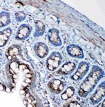 SSR3 Antibody in Immunohistochemistry (Paraffin) (IHC (P))