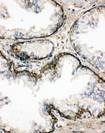 SSR3 Antibody in Immunohistochemistry (Paraffin) (IHC (P))