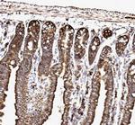 SSR3 Antibody in Immunohistochemistry (Paraffin) (IHC (P))