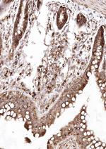 SSR3 Antibody in Immunohistochemistry (Paraffin) (IHC (P))