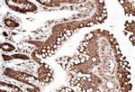 SSR3 Antibody in Immunohistochemistry (Paraffin) (IHC (P))