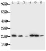 SSR3 Antibody in Western Blot (WB)