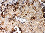 STIM1 Antibody in Immunohistochemistry (Paraffin) (IHC (P))