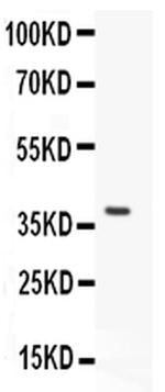 STRA8 Antibody in Western Blot (WB)