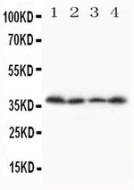 STRA8 Antibody in Western Blot (WB)