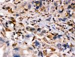 TAP1 Antibody in Immunohistochemistry (Paraffin) (IHC (P))