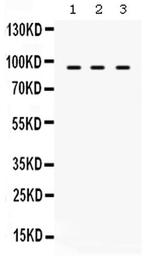 TAP1 Antibody in Western Blot (WB)