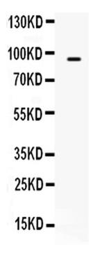 TAP2 Antibody in Western Blot (WB)