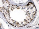 TCP1 Antibody in Immunohistochemistry (Paraffin) (IHC (P))