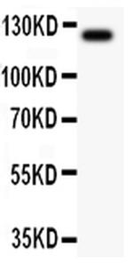 TIE2 (TEK) Antibody in Western Blot (WB)