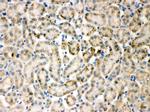 TIMP4 Antibody in Immunohistochemistry (Paraffin) (IHC (P))