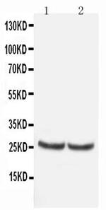 TIMP4 Antibody in Western Blot (WB)