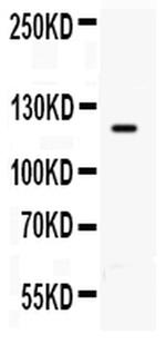 TLR8 Antibody in Western Blot (WB)