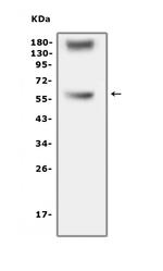 TNFR1 Antibody in Western Blot (WB)