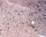 Tenascin R Antibody in Immunohistochemistry (Paraffin) (IHC (P))