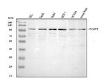 TOP1 Antibody in Western Blot (WB)