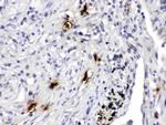 Tryptase Antibody in Immunohistochemistry (Paraffin) (IHC (P))