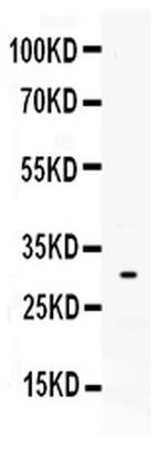 Tryptase Antibody in Western Blot (WB)