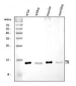 Transthyretin Antibody in Western Blot (WB)