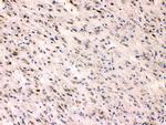 Beta III Tubulin Antibody in Immunohistochemistry (Paraffin) (IHC (P))