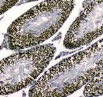 UBA2 Antibody in Immunohistochemistry (Paraffin) (IHC (P))