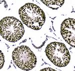 UBA2 Antibody in Immunohistochemistry (Paraffin) (IHC (P))