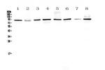 UBA2 Antibody in Western Blot (WB)