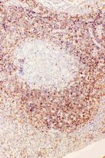 UBD Antibody in Immunohistochemistry (Paraffin) (IHC (P))