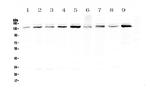 USP7 Antibody in Western Blot (WB)