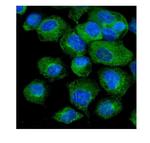 VAPB Antibody in Immunocytochemistry (ICC/IF)