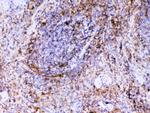 VCAM-1 (CD106) Antibody in Immunohistochemistry (Paraffin) (IHC (P))