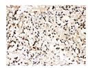 VCP Antibody in Immunohistochemistry (Paraffin) (IHC (P))