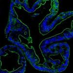 Villin Antibody in Immunohistochemistry (Paraffin) (IHC (P))