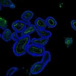 Villin Antibody in Immunohistochemistry (Paraffin) (IHC (P))