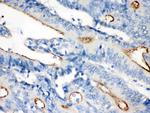 Villin Antibody in Immunohistochemistry (Paraffin) (IHC (P))