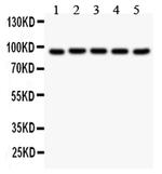 Villin Antibody in Western Blot (WB)