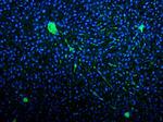 VWF Antibody in Immunohistochemistry (IHC)