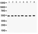 WASP Antibody in Western Blot (WB)