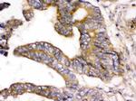 WNK1 Antibody in Immunohistochemistry (Paraffin) (IHC (P))