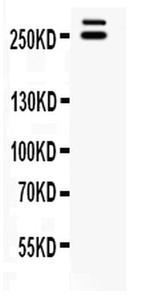 WNK1 Antibody in Western Blot (WB)