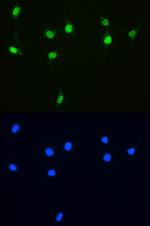 XRCC1 Antibody in Immunocytochemistry (ICC/IF)