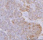 YBX1 Antibody in Immunohistochemistry (Paraffin) (IHC (P))