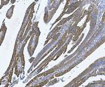 YBX1 Antibody in Immunohistochemistry (Paraffin) (IHC (P))