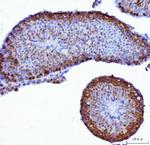 YBX1 Antibody in Immunohistochemistry (Paraffin) (IHC (P))