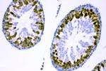 YBX1 Antibody in Immunohistochemistry (Paraffin) (IHC (P))