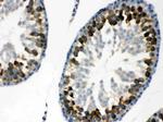 YBX1 Antibody in Immunohistochemistry (Paraffin) (IHC (P))