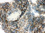 YBX1 Antibody in Immunohistochemistry (Paraffin) (IHC (P))